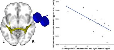 Insights Into Auditory Cortex Dynamics From Non-invasive Brain Stimulation